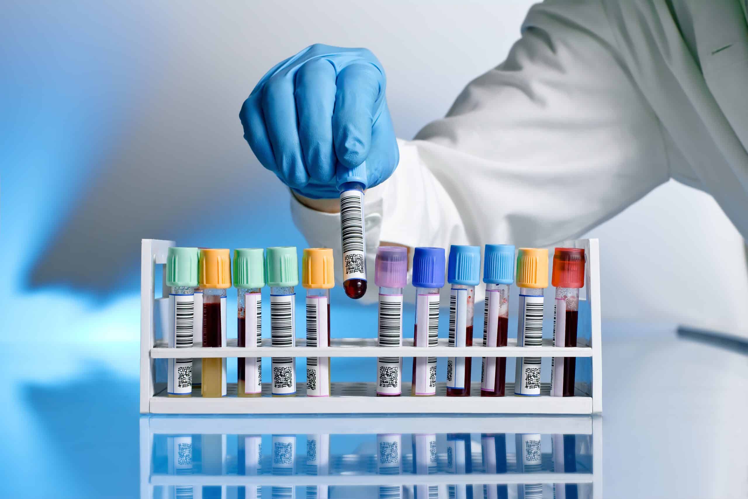barcoded test tubes